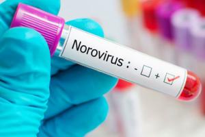 norovirus outbreak in test tube